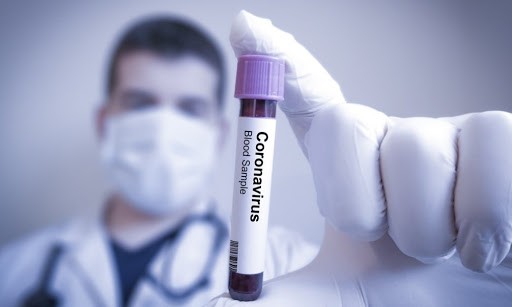 565 casos y un muerto confirmado en últimas horas por coronavirus